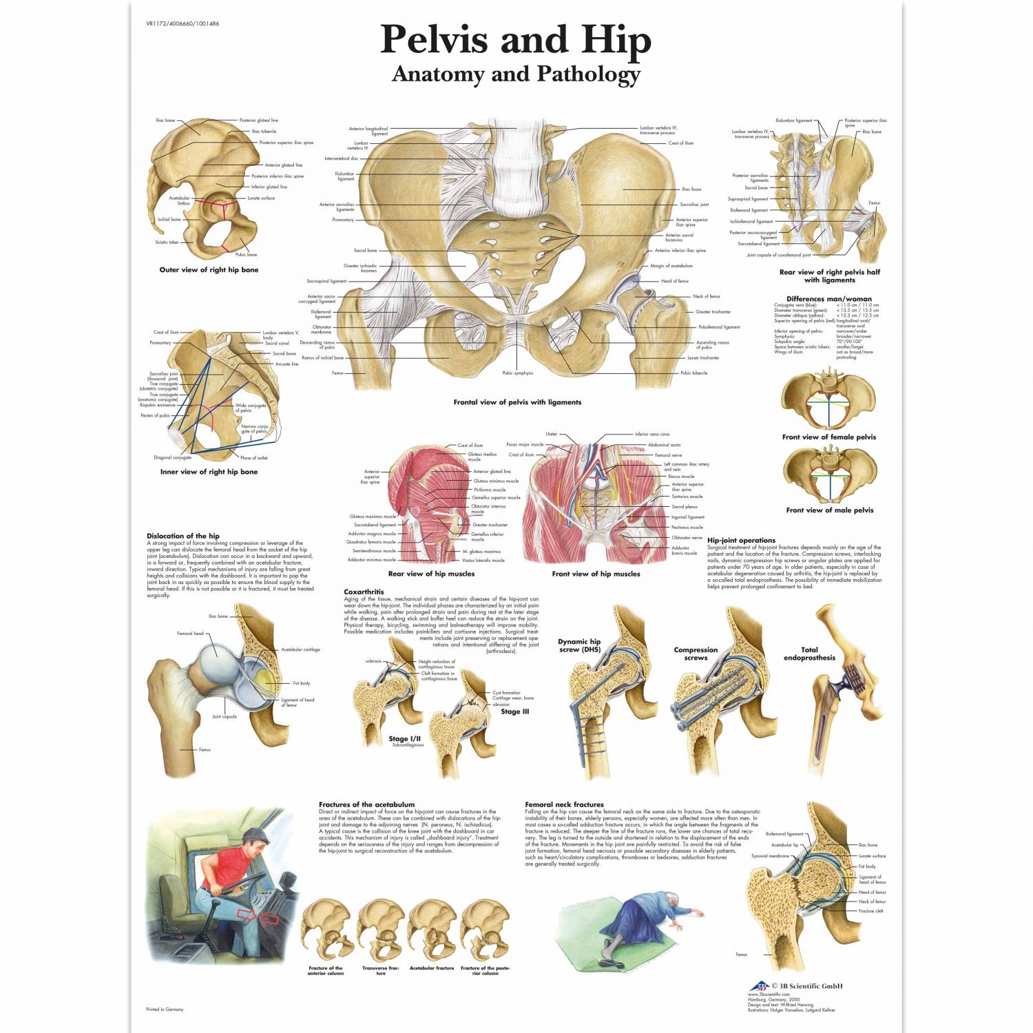 Pancarte murale plastifiée Pelvis an Hip - 50 x 67 cm