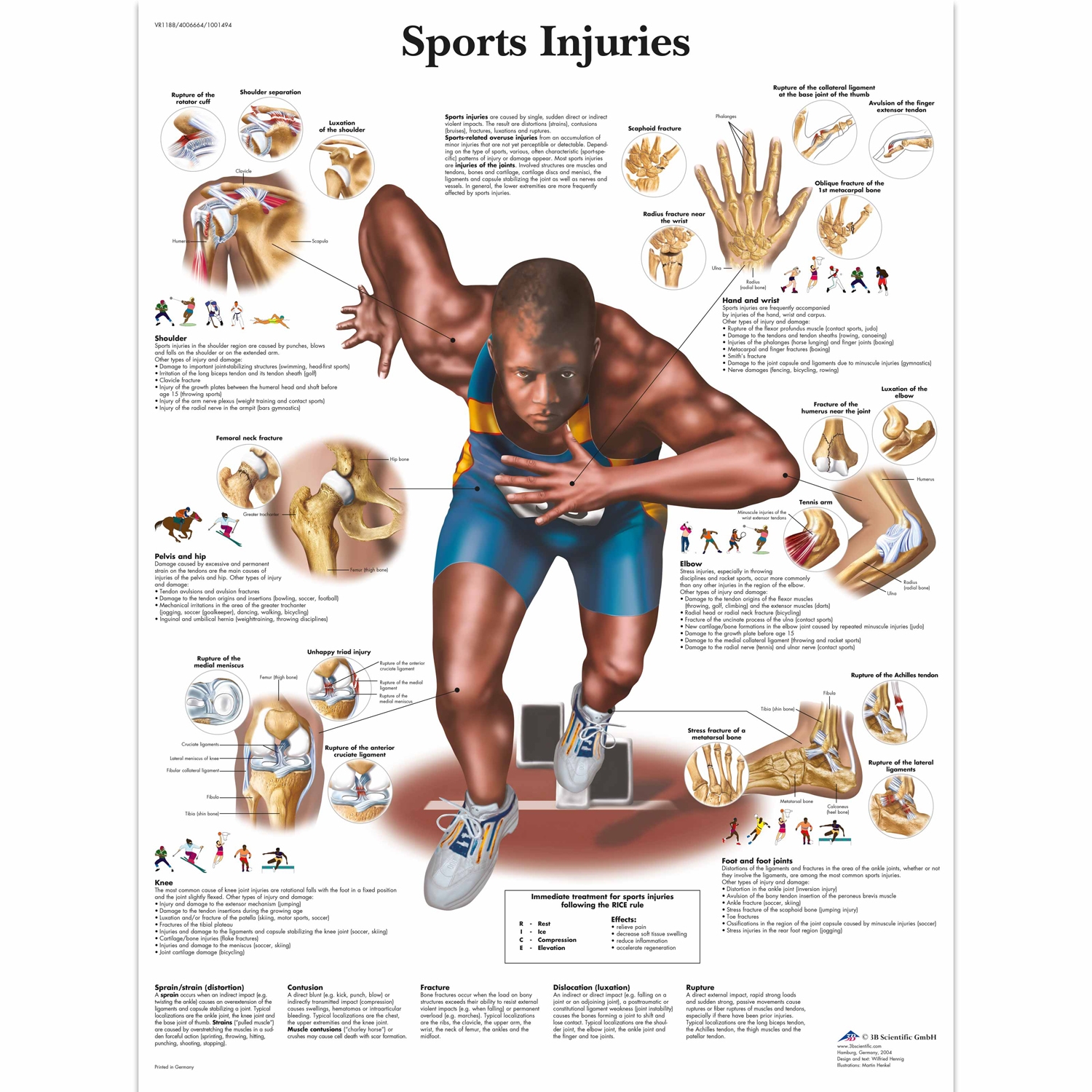 Pancarte murale plastifiée Sports Injuries - 50 x 67 cm